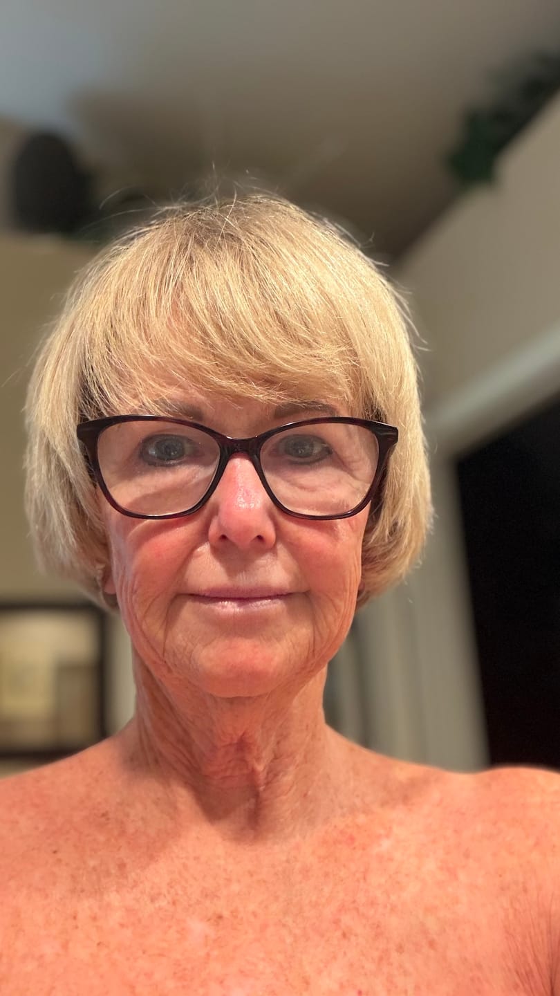 Kundrecension med foto av 3 månaders förbrukning - Novacares mikroinfusionssystem