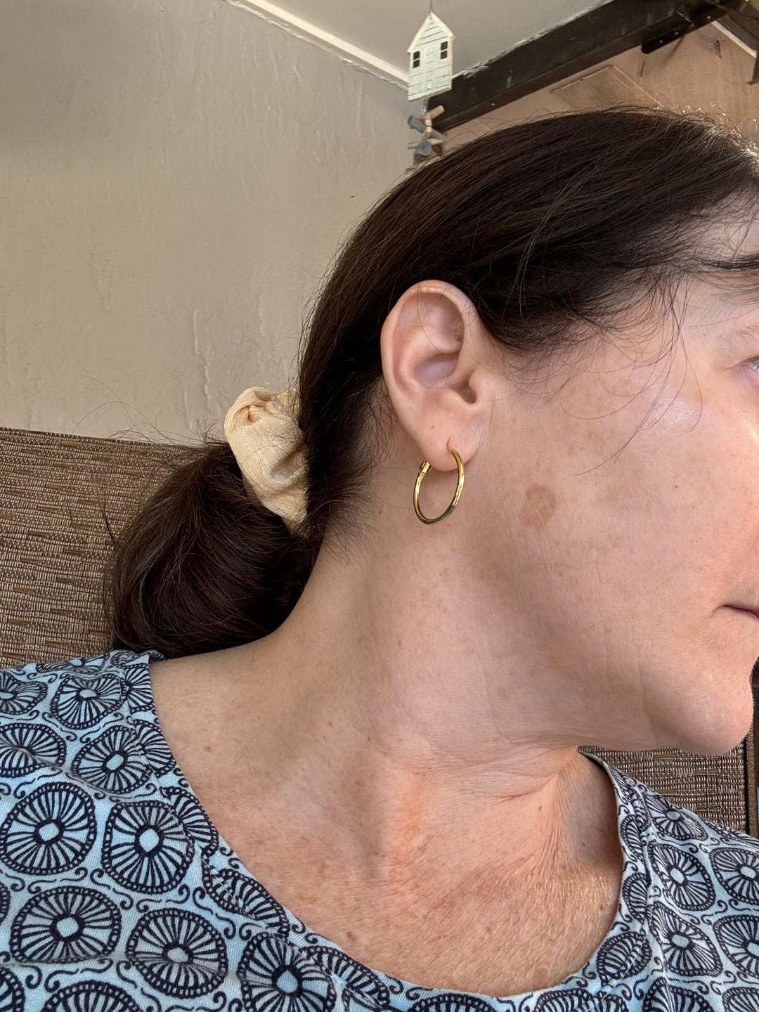 Kundrecension med foto av 3 månaders förbrukning - Novacares mikroinfusionssystem